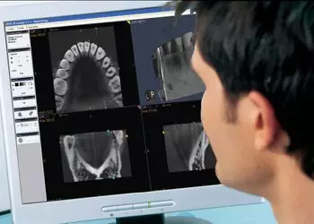 Рентгеновский снимок зубов при диагностики