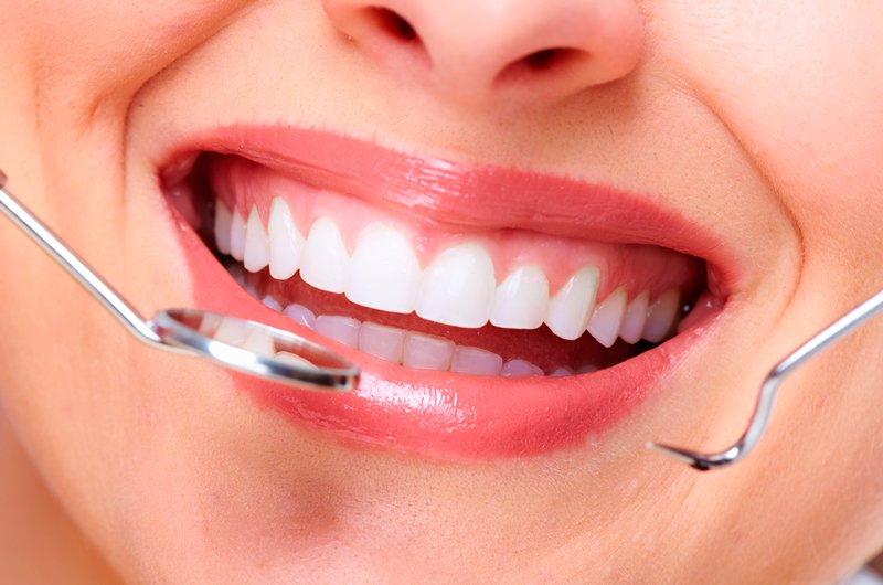 При правильном последующем после чистки зубов уходе эффект сохраняется годами. 