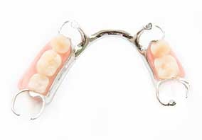 Бюгельный протез состоит из металлической дуги, на которой фиксируются искусственные зубы.