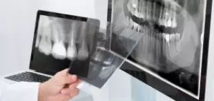 рентген перед имплантацией зубов