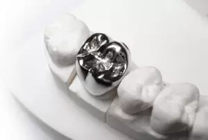Металлическая коронка на зуб