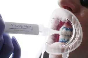 Процедура отбеливания зубов Amazing White