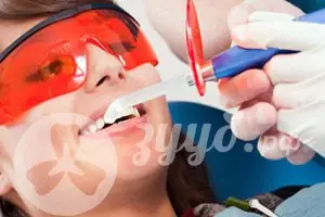 Ультразвуковая чистка в стоматологии Зууб.рф