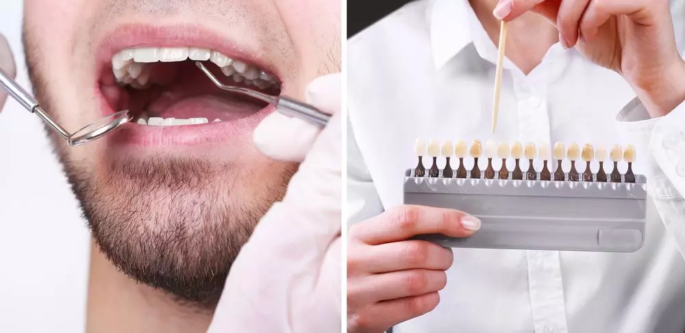 Только стоматолог может порекомендовать, какой именно метод отбеливания зубов подойдет в каждом случае, исходя из состояния зубов, эмали в том числе.