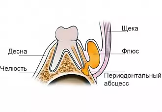 Виды мазей для десен